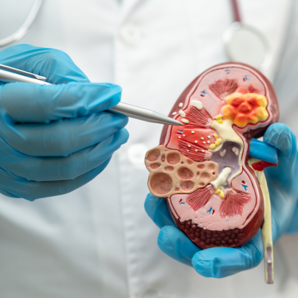 kidney training